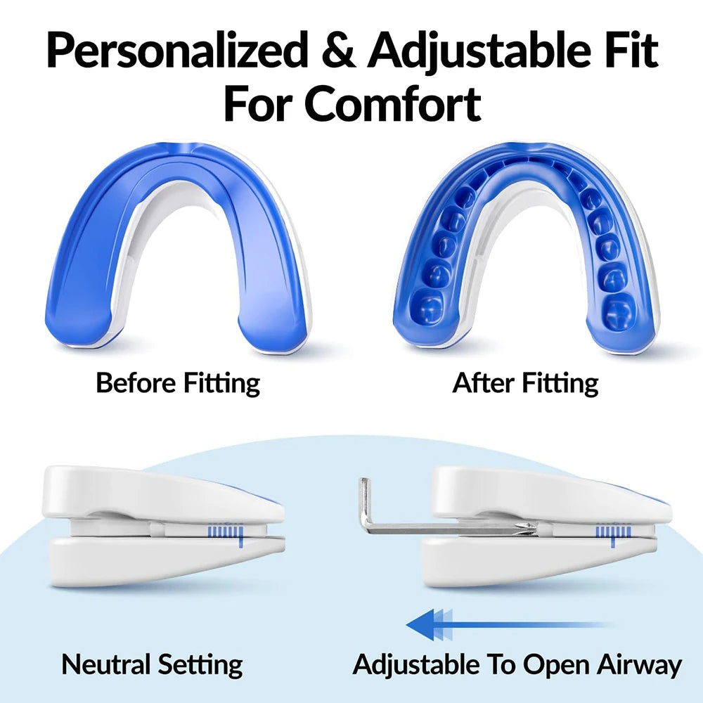 Snore No More — Anti-Snoring Mouthpiece by Silent Nights