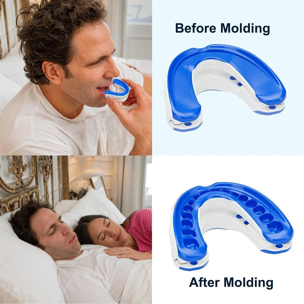 Snore No More — Anti-Snoring Mouthpiece by Silent Nights